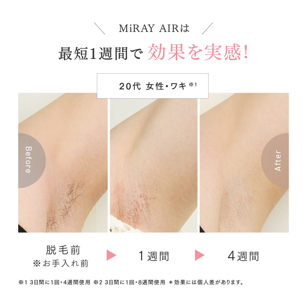 MiRAY AIRは最短1週間で脱毛効果を実感